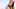 Frau cremt sich den Arm ein - Foto: Alamy