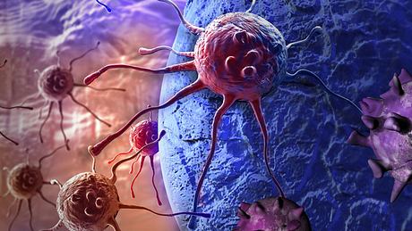 Krebszellen - Foto: Fotolia