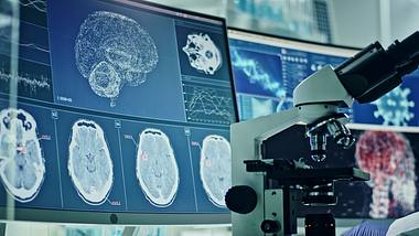 Aufzeichnungen eines Gehirns im Labor - Foto: iStock/janiecbros