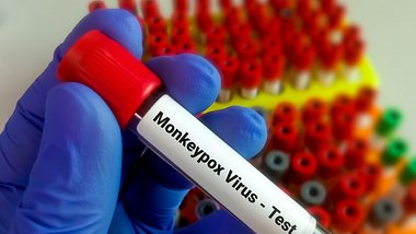 Test für das Affenpocken-Virus - Foto: iStock/Md Saiful Islam Khan
