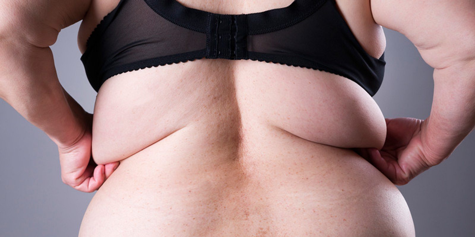 Толстое тело женщины