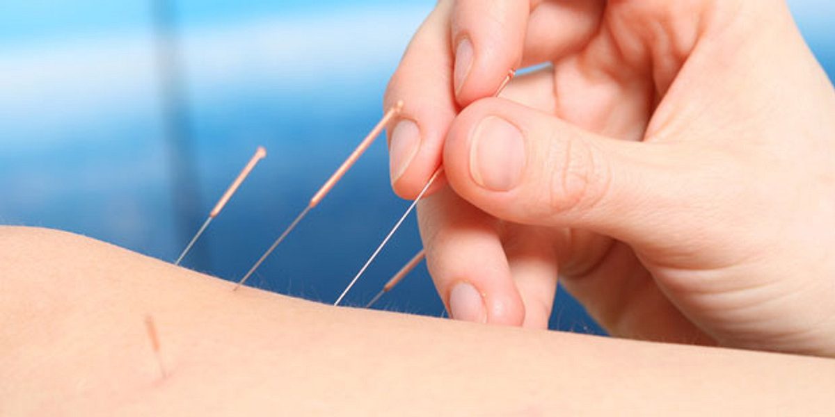 Akupunktur hilft bei Skoliose