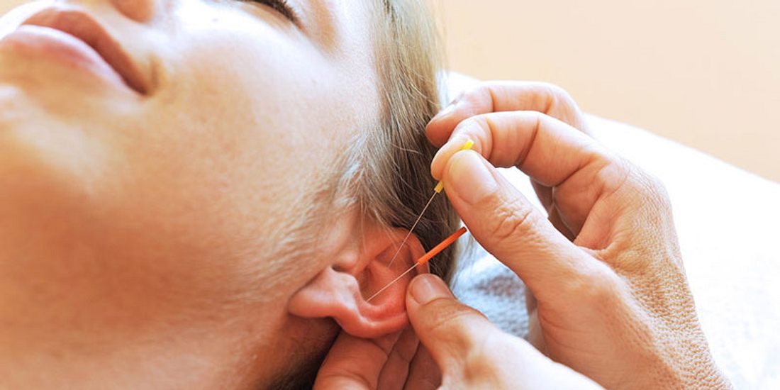 Akupunktur gegen Schwitzen im Gesicht