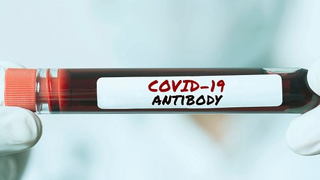 Corona Antikörpertest - Foto: iStock/kemalbas