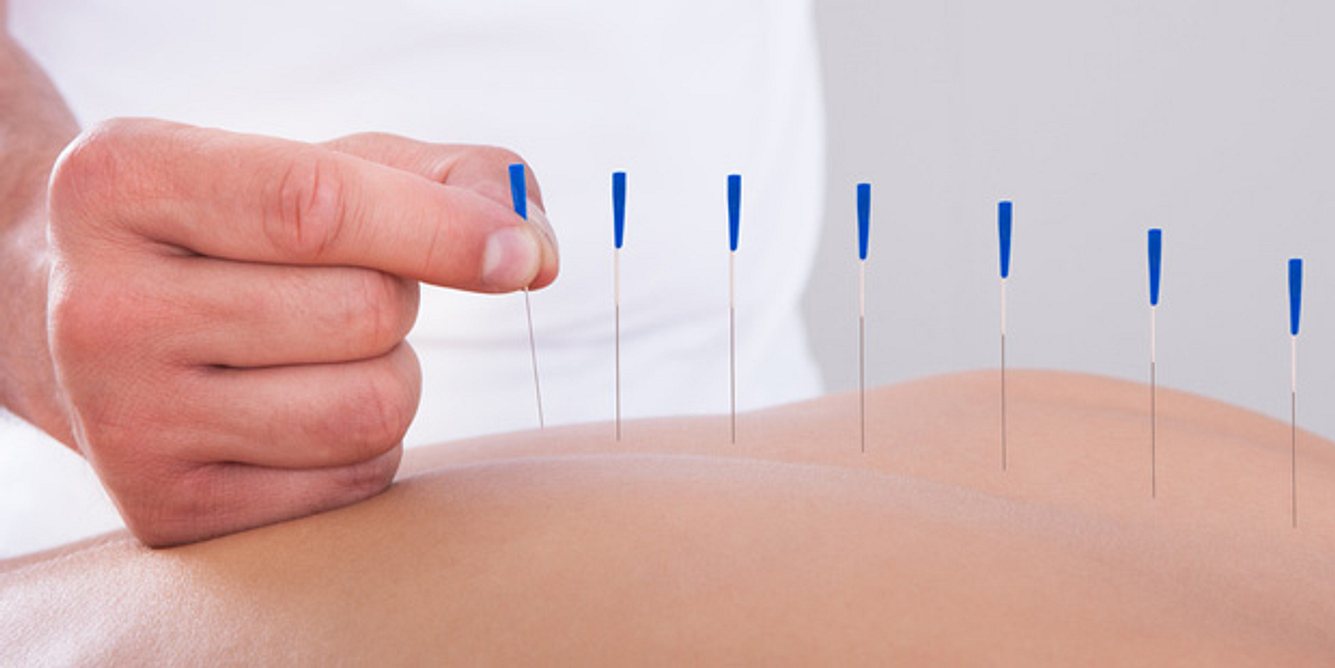 Akupunktur hat sich als alternative Heilmethode bei Arthritis bewährt