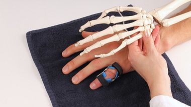 Arthritis beginnt in den kleinen Gelenken. Deshalb zeigt sich diese Erkrankung meist zuerst in den Fingern oder Zehen
