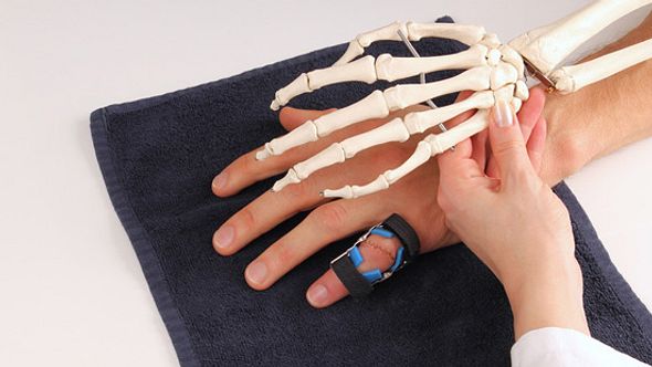 Arthritis beginnt in den kleinen Gelenken. Deshalb zeigt sich diese Erkrankung meist zuerst in den Fingern oder Zehen