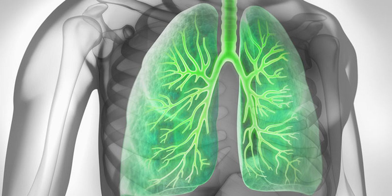 Asthma
