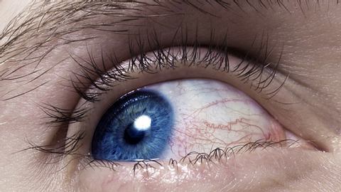 Augenentzündung – welche Ursachen gibt es?