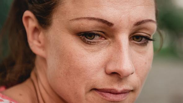 Eine Frau mit dunklen Augenringen - Foto: istock_Kerkez