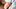 Frau juckt sich am Oberschenkel wegen Ausschlag - Foto: iStock/Jomkwan