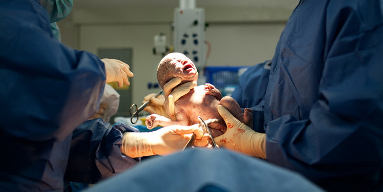 Bei einer Schwangerschaftsvergiftung ist eine frühzeitige Entbindung in einigen Fällen der letzte Ausweg