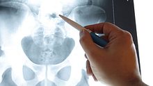 Bei der Penisbruch-Diagnose kommen bildgebende Verfahren wie Röntgen und MRT zum Einsatz - Foto: Fotolia