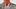 Zeichnet sich im vorderen Halsbereich eine sichtbare Beule ab, kann dies ein Zeichen für eine Schilddrüsenvergrößerung sein - Foto: shutterstock