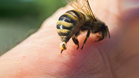 Eine Biene krabbelt über die Haut eines Menschen - Foto: iStock/Inventori