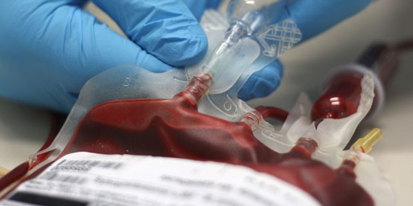 Bei starkem Blutverlust kann eine Transfusion sinnvoll sein