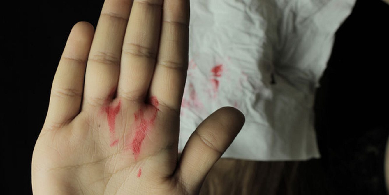 Eine blutige Handfläche