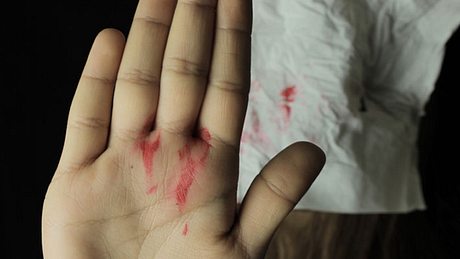 Eine blutige Handfläche - Foto: iStock