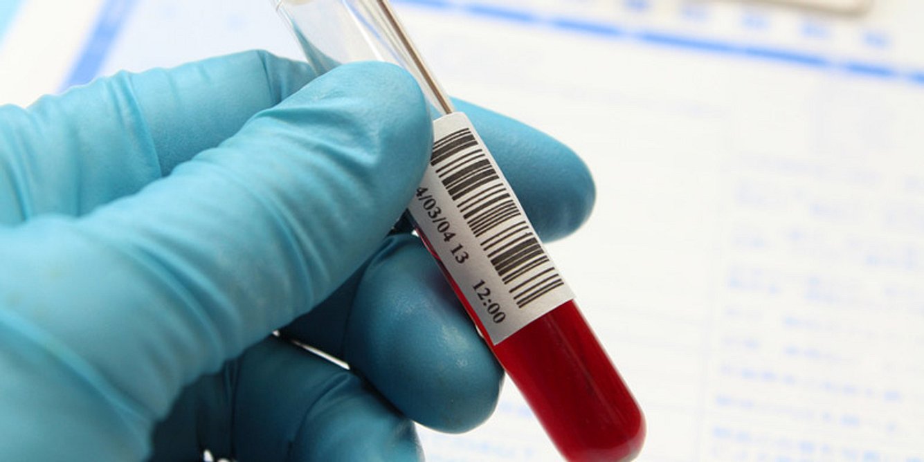 Ein Mediziner hält eine Blutprobe in der Hand