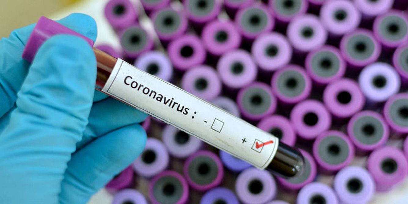 Eine Blutprobe mit Conoraviren