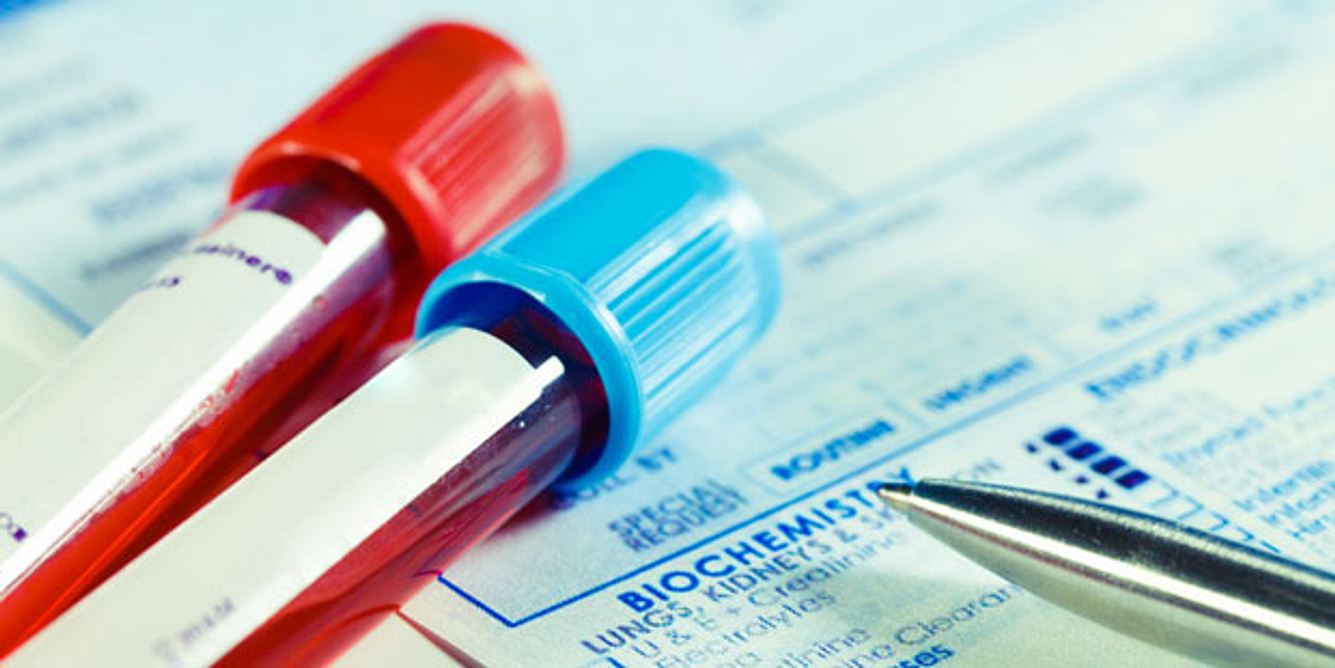 Zwei Ambullen mit Blut