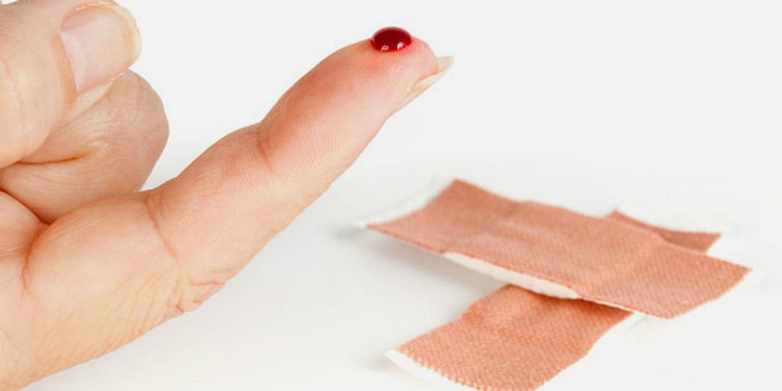 Eine Fingerwunde führt selten zu Blutvergiftung