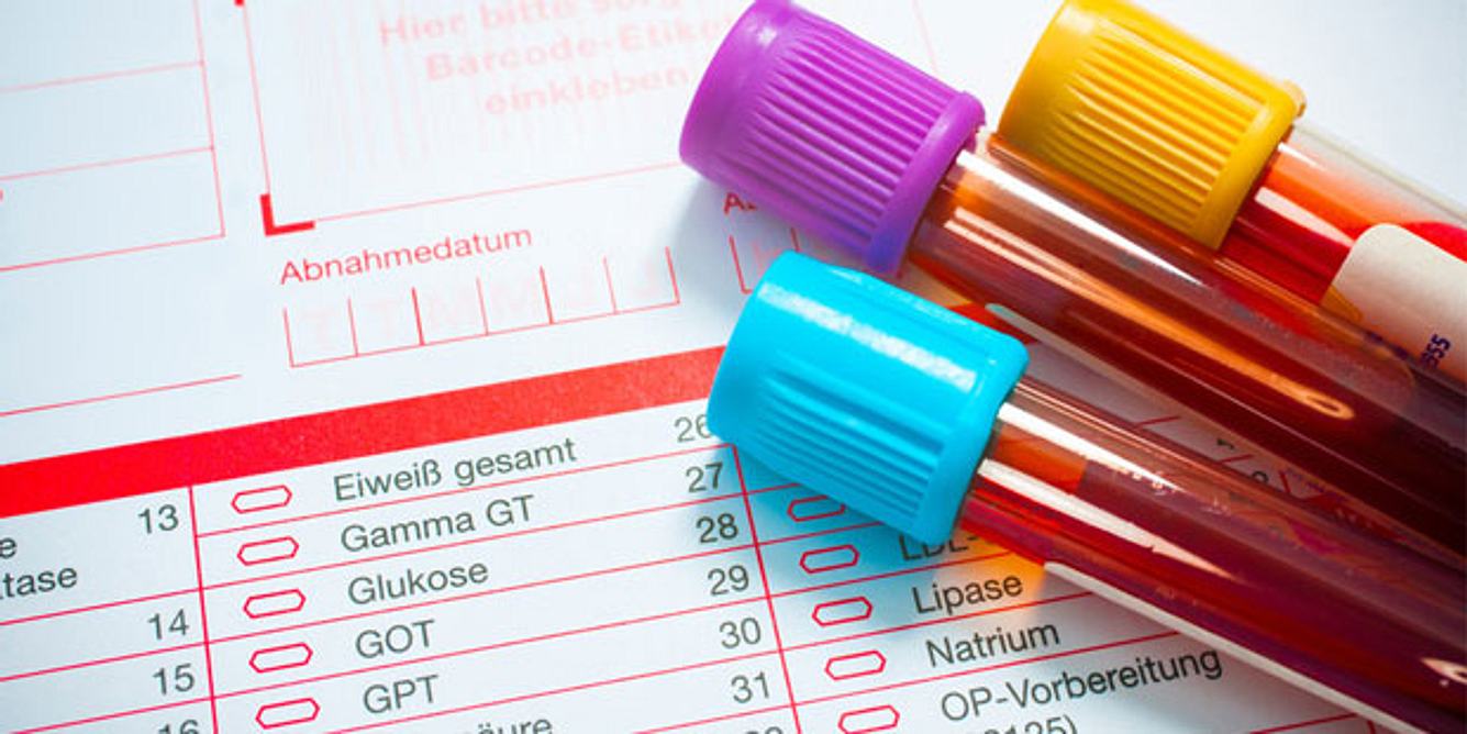 Blutwerte können einen Eisenmangel aufzeigen
