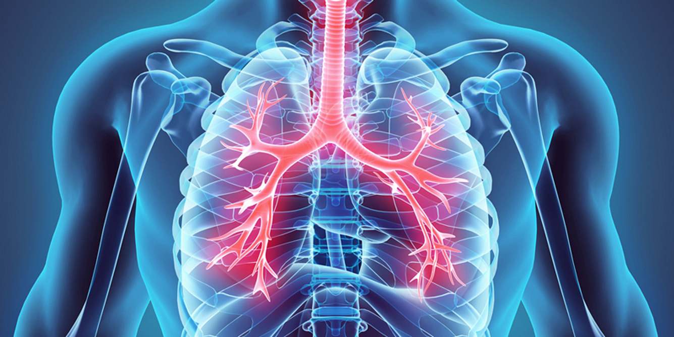 Typische Bronchitis-Symptome sind Reizhusten und Auswurf | PraxisVITA