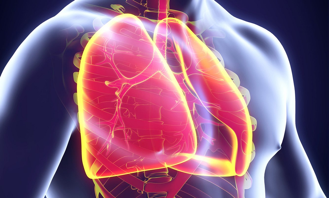 Bronchitis durch Nasenpolypen