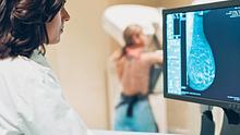 Eine Frau bei einer Mammographie.  - Foto: iStock / pixelfit