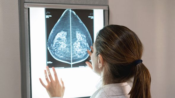 Ärztin schaut sich Röntgenbild an - Foto: iStock/andresr
