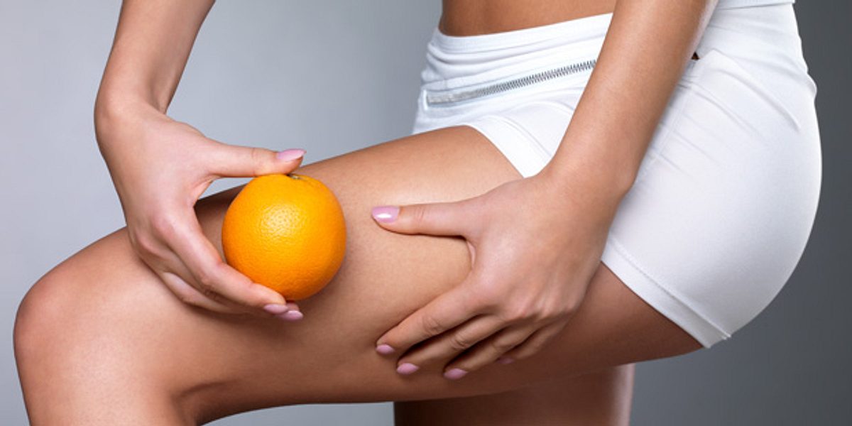 Sind auch Sie, wie viele andere Frauen, von Cellulite betroffen? In der Bildergalerie erfahren Sie, was wirklich gegen Cellulite hilft