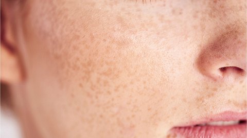 Gesichtshaut Nahaufnahme - Foto: iStock/gpointstudio