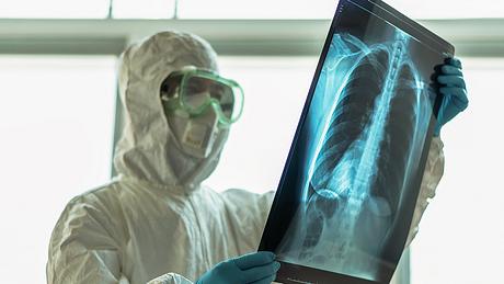 Einige Organe werden besonders stark vom Coronavirus befallen - Foto: iStock | Chinnapong