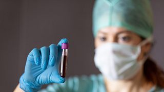 Ärztin hält Blutprobe in der Hand - Foto: iStock / kentarus