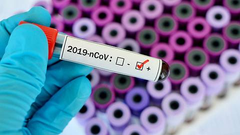 Blutprobenröhrchen positiv mit Coronavirus - Foto: iStock / jarun011
