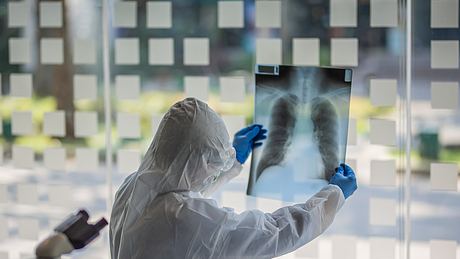 Arzt überprüft Brust-Röntgenfilm im Krankenhaus - Foto: iStock / Udom Pinyo