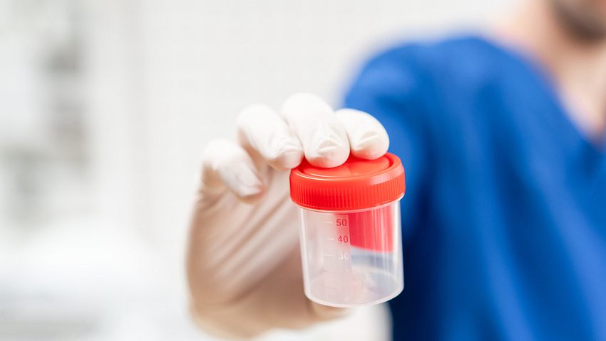 Arzt hält leeren Kunststoffbehälter für Urinprobe in der Hand - Foto: iStock / Sergey Mikheev