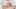Frau trägt Cortison-Salbe auf - Foto: Alamy