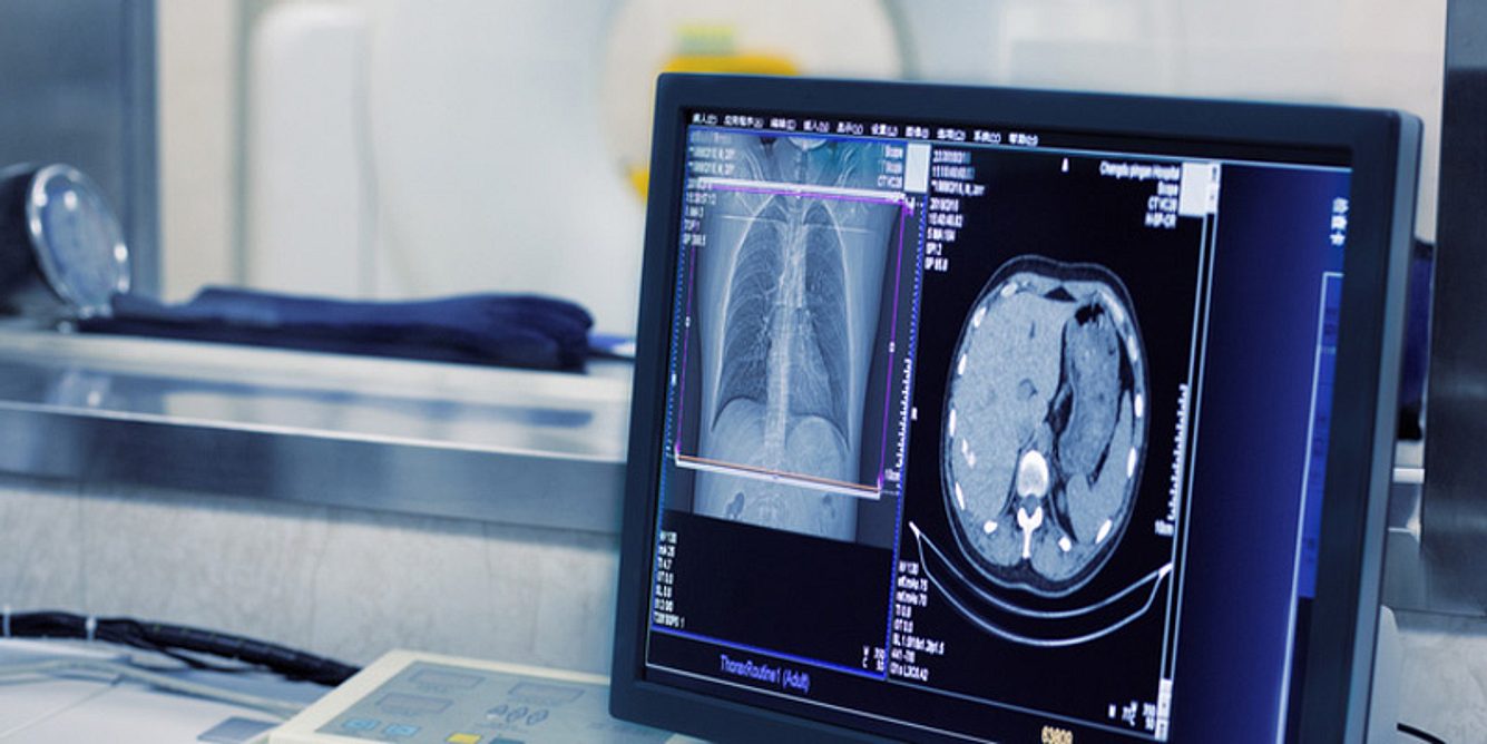 CT für die Muskelschmerzen-Diagnose
