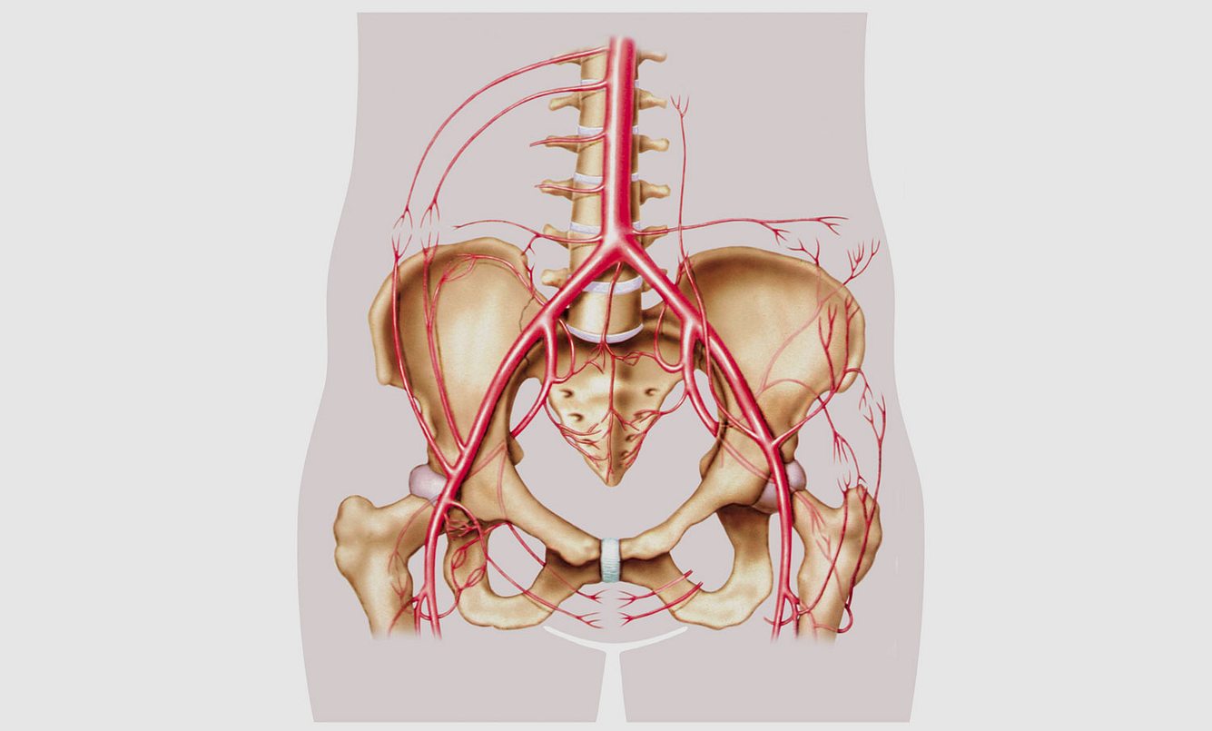 Die Aorta (Hauptschlagader) geht in die beiden Darmbeinarterien über. Ist eine davon verstopft oder abgeklemmt (wie bei dem Australier durch den vergrößerten Darm), wird das Bein nicht mehr ausreichend mit Blut versorgt