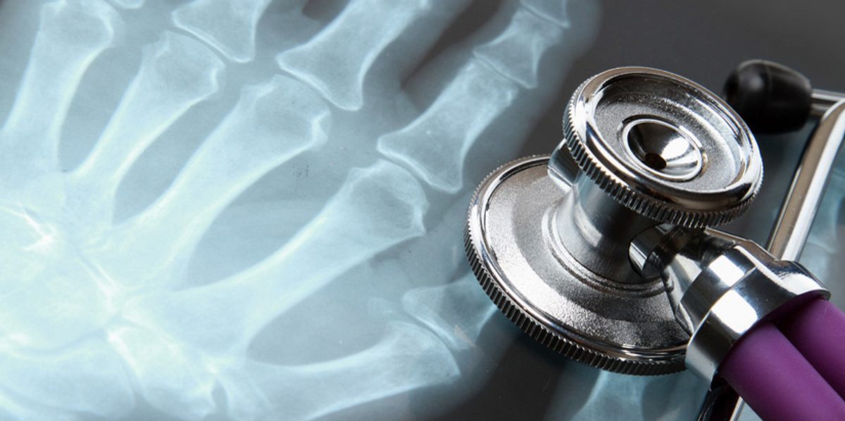 Röntgenbilder sind aus der Medizin nicht mehr wegzudenken. Mit dem Röntgen-Verfahren können Fremdkörper, Knochenbrüche, Tumoren und sogar ein Darmverschluss sichtbar gemacht werden