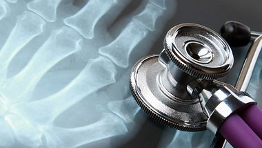 Röntgenbilder sind aus der Medizin nicht mehr wegzudenken. Mit dem Röntgen-Verfahren können Fremdkörper, Knochenbrüche, Tumoren und sogar ein Darmverschluss sichtbar gemacht werden - Foto: Fotolia