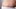 Frau mit Dehnungsstreifen an der Hüfte - Foto: iStock/Staras