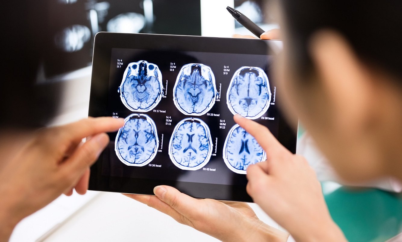 Ein Tumor kann durch ein CT diagnostiziert werden