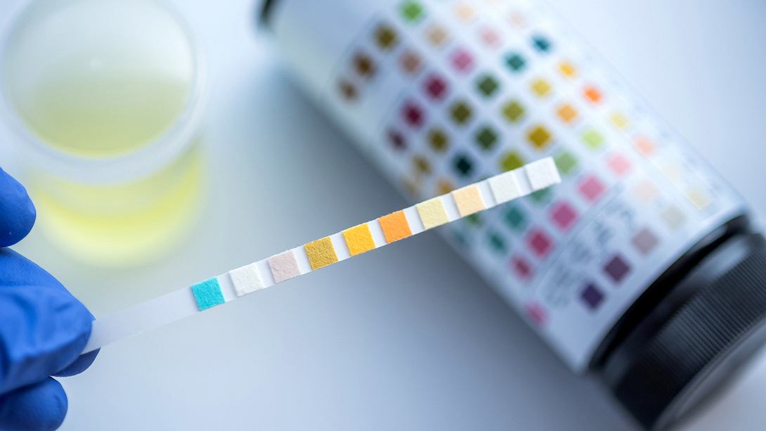 Teststreifen für Urinschnelltest mit Urinprobe und Farbfeldern zum Auswerten - Foto: iStock/Lothar Drechsel