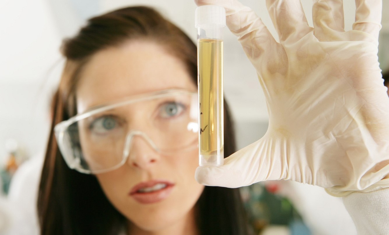 Frau hält Reagenzglas mit Urin kritisch in die Höhe