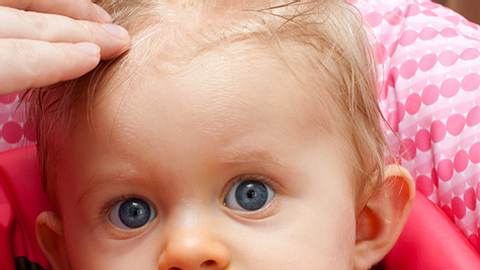 Milchschorf auf der Kopfhaut beim Baby ist völlig harmlos - Foto: Fotolia
