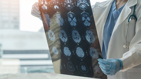 Person hält Hirnscan in der Hand - Foto: istock/Chinnapong