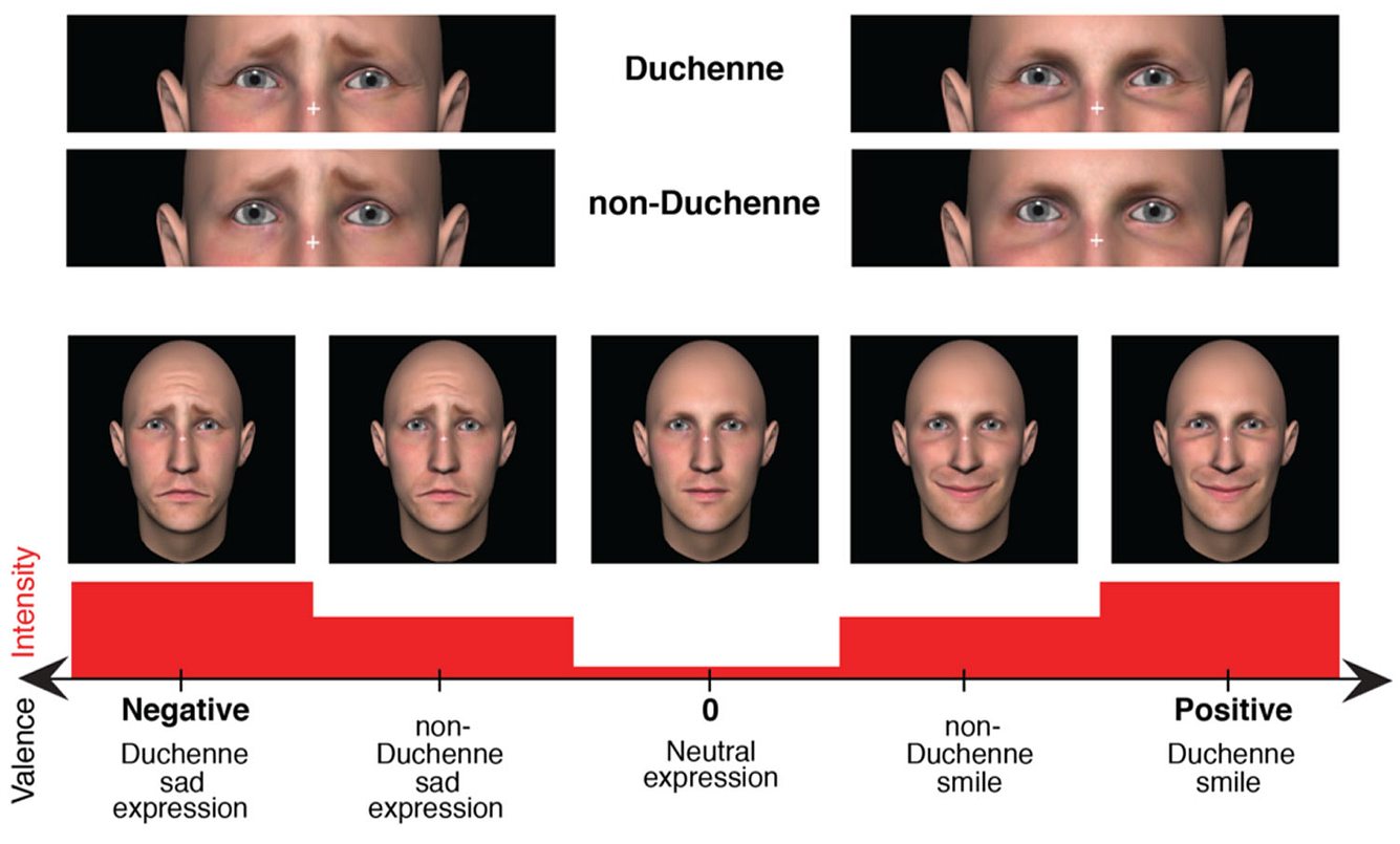 Grafik der University of Western Ontario zum Duchenne-Lächeln